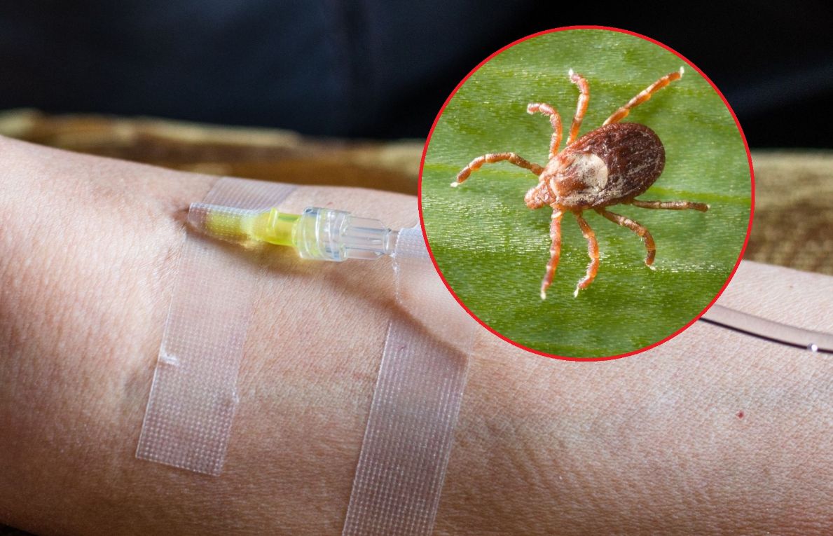 Leczenie boreliozy. Czy ozonoterapia i wlewy z witaminy C są skuteczne?