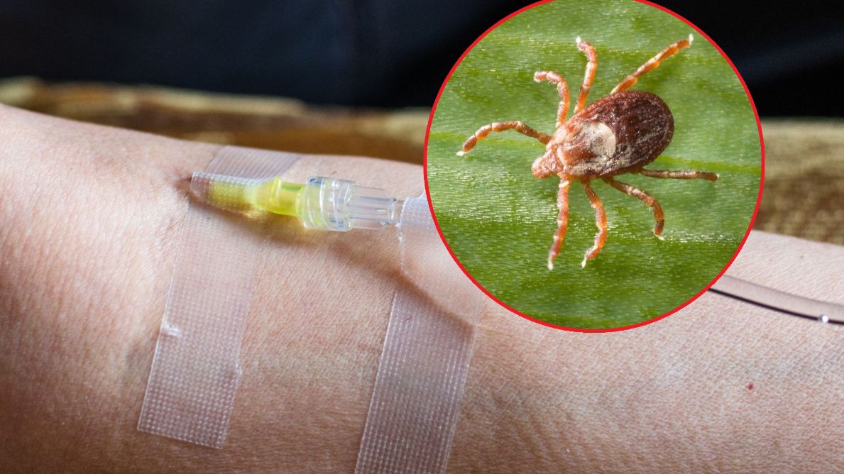 Choroba odkleszczowa - borelioza