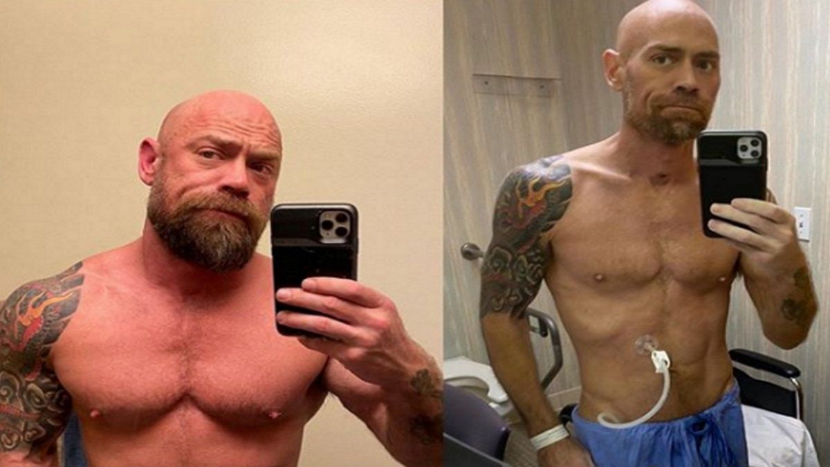 43-latek pokazał, w jaki sposób jego ciało zmieniło się pod wpływem koronawirusa