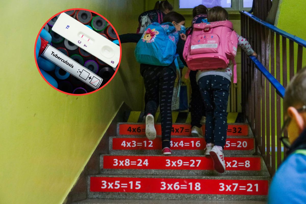 Świnoujście. Gruźlica w szkole. Sanepid wydał komunikat