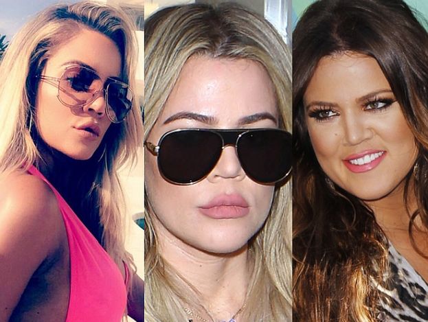 Khloe Kardashian znów powiększyła usta... (FOTO)