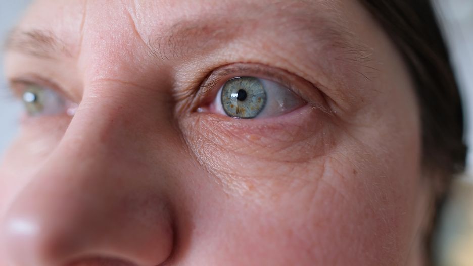 close up and front view on the blue eye of a mature caucasian woman in her forties, showing heavy wrinkles (crow's feet) in the corner and below the eye, with copy-space
eyes, face, woman, age, botox, female, skin, facial massage, decorative, increase, acid, pump up, cosmetics, rejuvenation, injection, texture, natural, cosmetic, fragrance, chubby, anti-aging, procedures, facial, massage, shape, wrinkles, eyelids, gray, lenses, vision, health, treatment, medicine, oculist, testing, examining, eye care, person, forehead, overhang, correction, ophthalmology, caucasian, consultation, checkup, iris, spots