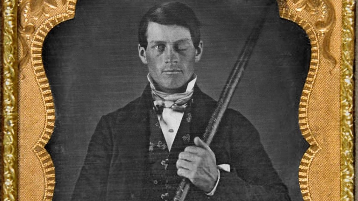 Phineas Gage
