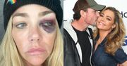 Denise Richards oskarża męża o przemoc. "Groził, że złamie mi szczękę. Często mnie GWAŁTOWNIE DUSIŁ"