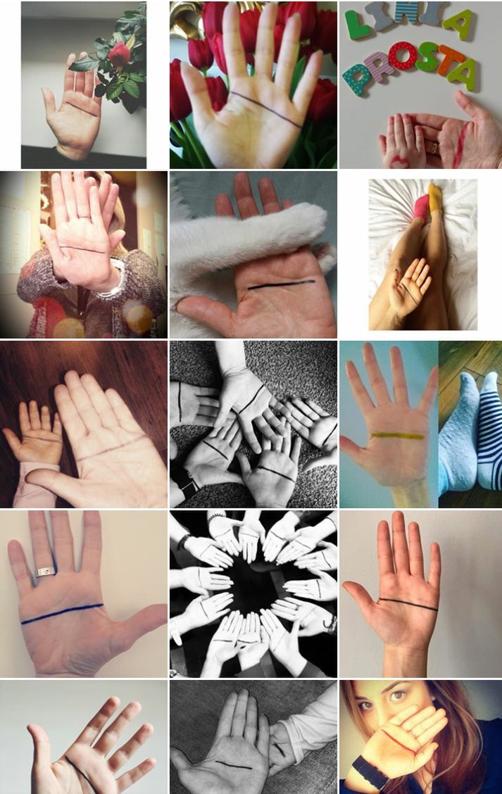 Każdy z nas może pomóc osobom z zespołem Downa