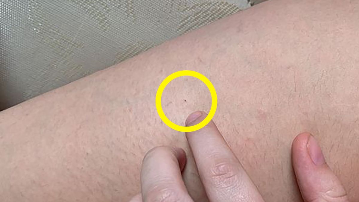 Nastolatki w klubach mają być odurzane narkotykami przy pomocy igły