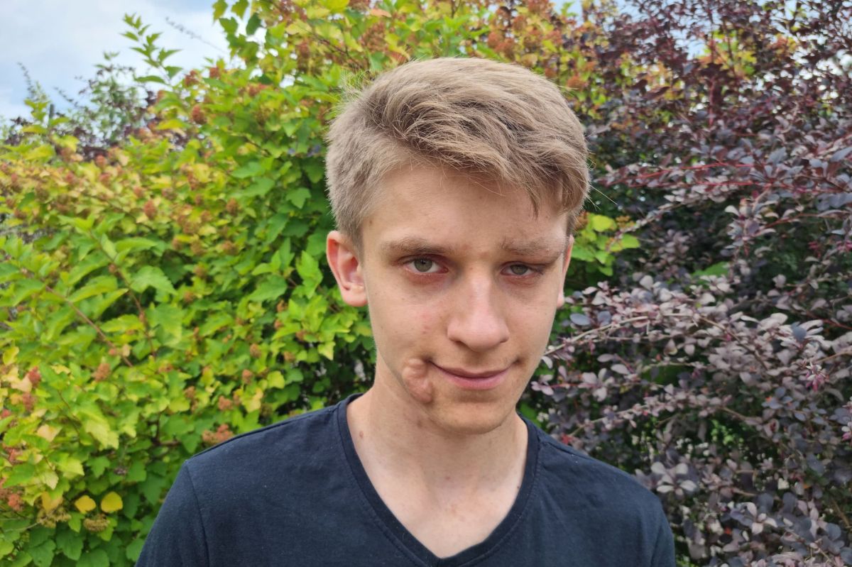 W ciele Michała w zastraszającym tempie rosną guzy. "Jesteśmy przerażeni"