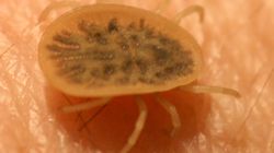 Obrzeżki gołębie - "ptasie" kleszcze, które atakują również ludzi