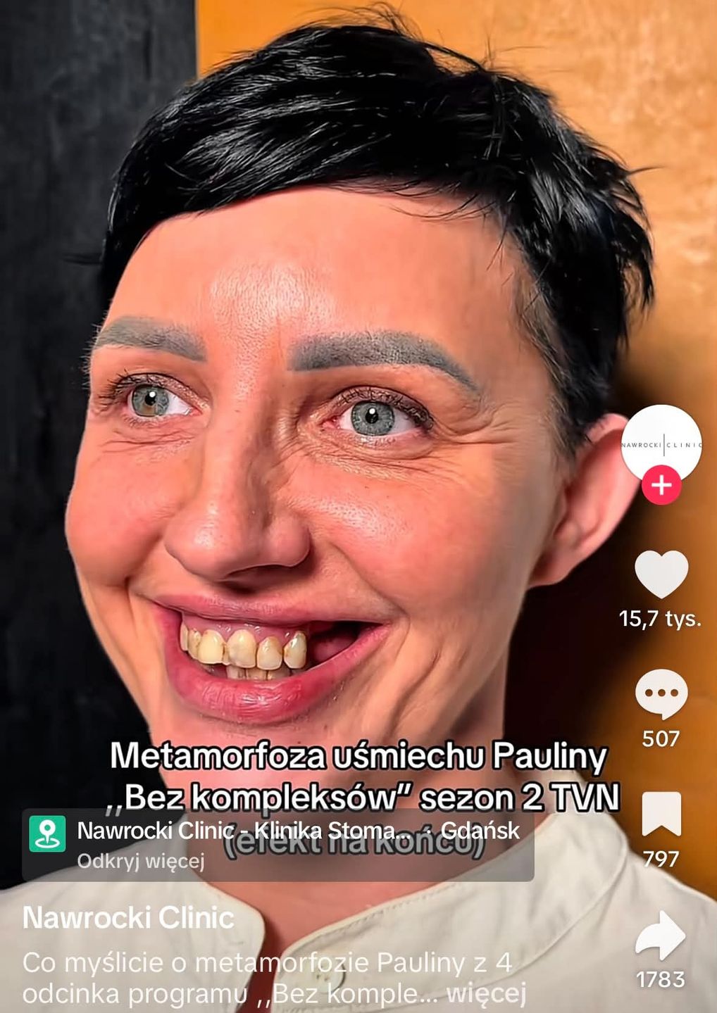 Metamorfoza zębów uczestniczki w programie "Bez kompleksów"