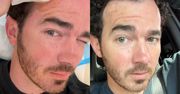 Kevin Jonas miał raka skóry. Przeszedł zabieg i zaapelował do fanów