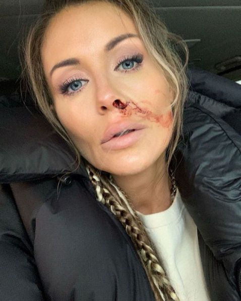 Małgorzata Rozenek dementuje, że zagra sutenerkę w filmie Vegi