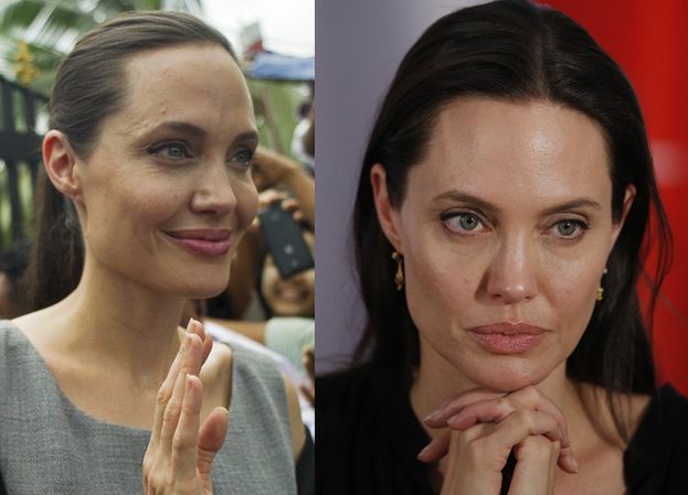 Chirurg plastyczny: "Angelina mogłaby wyglądać znacznie młodziej"