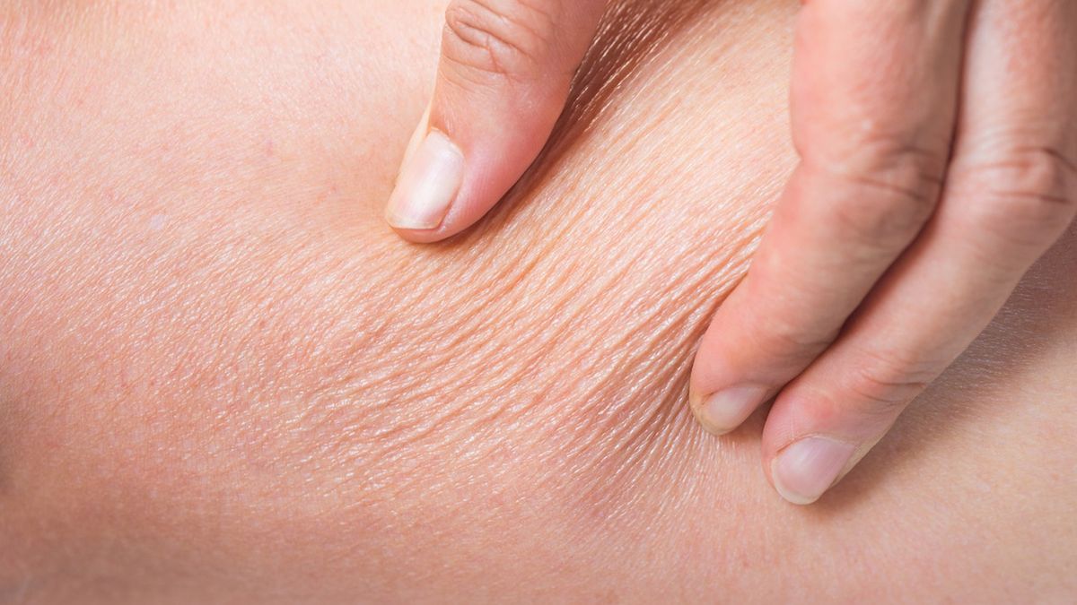 trockene Haut im Alter, Anzeichen einer Dehydrierung sucha skóra skóra nawilżanie 