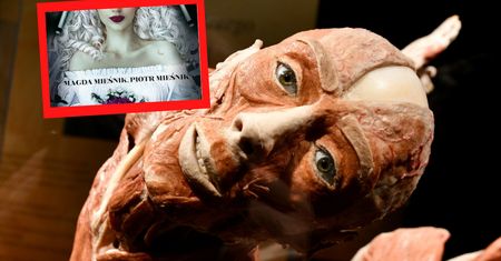 Doktor Frankenstein i plastynacja