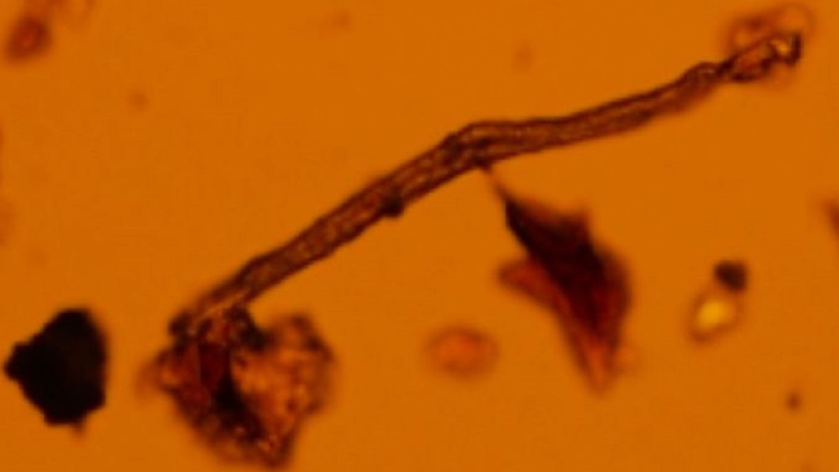 Mikroplastik odnaleziony w łożysku