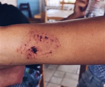 Zaatakował ją rekin, gdy pozowała do zdjęć na Instagram 3