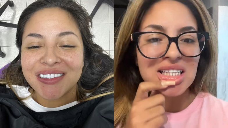 Zrobiła sobie nowe zęby w Meksyku. Pokazała, co stało się z nimi po miesiącu (FOTO)
