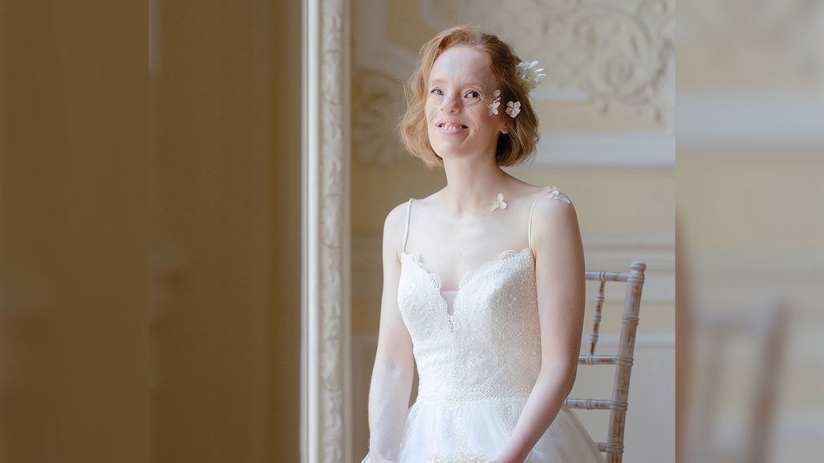 Miłość nie wyklucza. Ta sesja kobiet z niepełnosprawnościami wzrusza 1