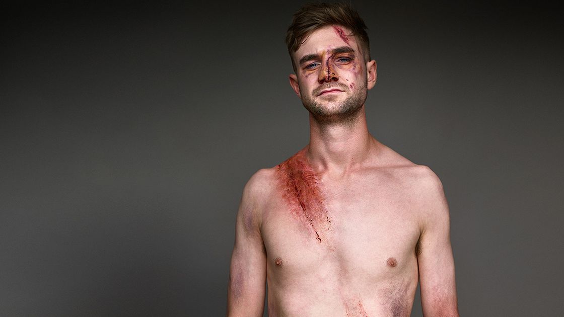 Pasy ratują życie. Zobacz genialne zdjęcia z kampanii społecznej 1