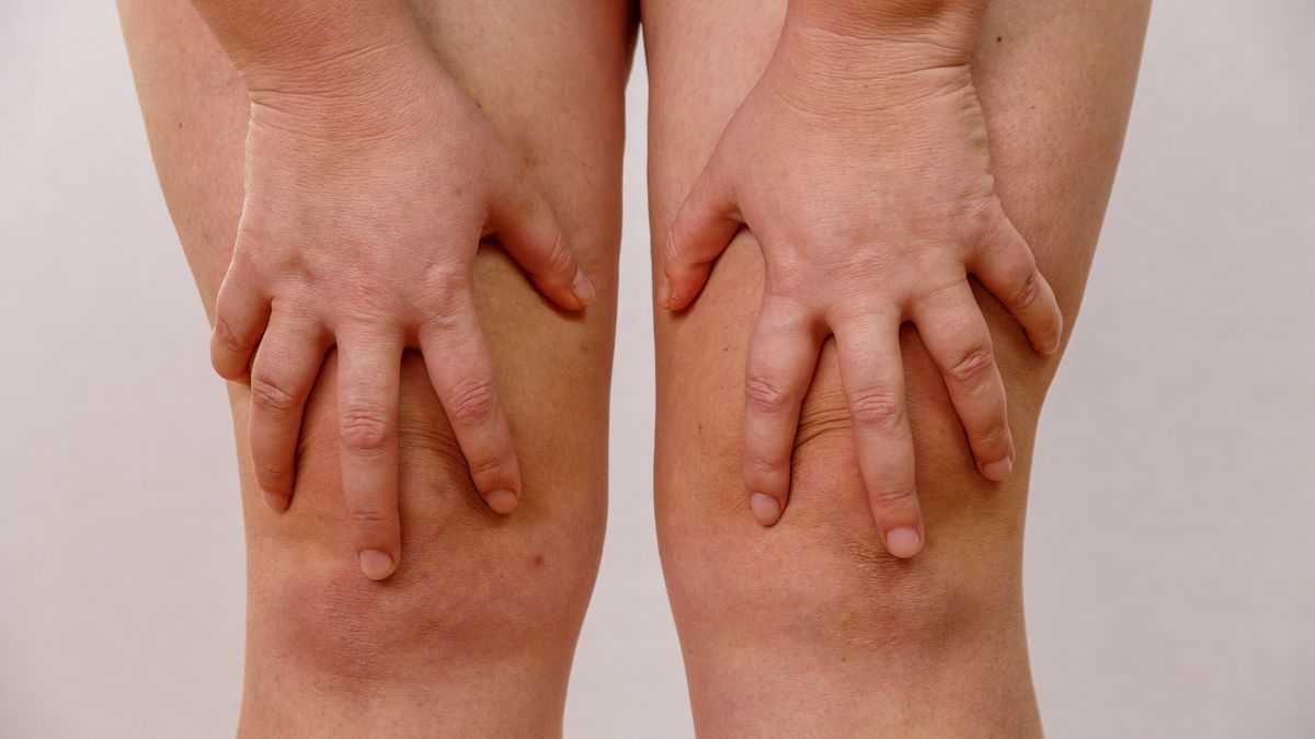 O czym świadczą spuchnięte kolana?
