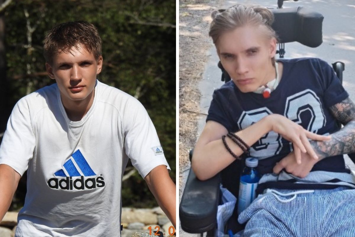 Filip, syn Pana Roberta, przed i po wypadku