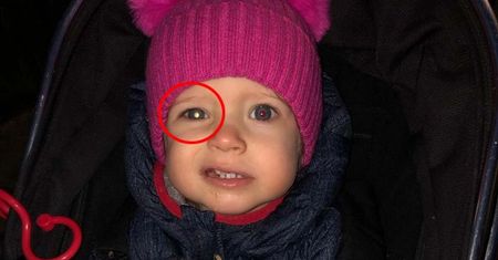 Niepokojący objaw zauważyła podczas zabawy z córką. Dostrzegła go na oku