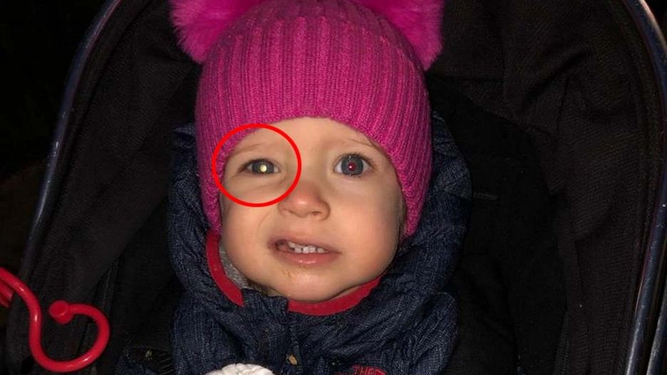 Zmianę dostrzegła podczas zabawy. Diagnoza ich przeraziła