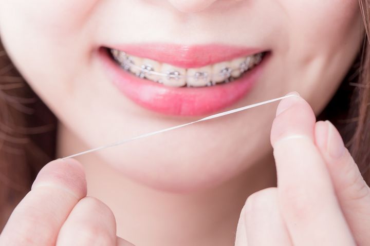 10 niesamowitych trików, które odmienią twoją higienę jamy ustnej podczas leczenia aparatem ortodontycznym