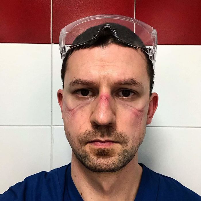 Lekarze i pielęgniarki po dyżurach. Te selfie pokazują twarze prawdziwych bohaterów 3