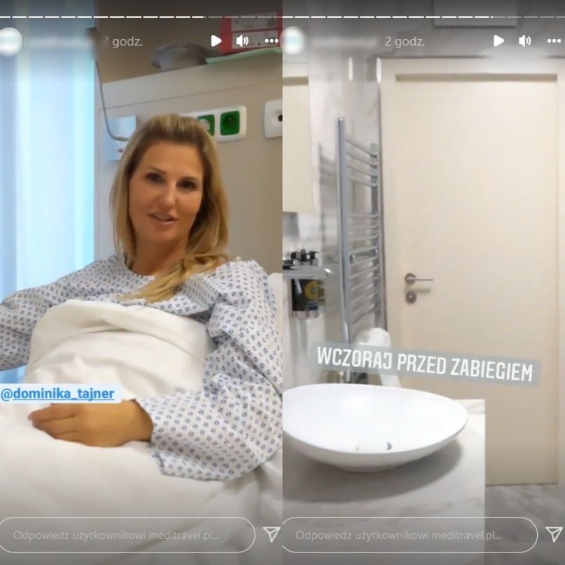 Dominika Tajner poddała się operacji rekonstrukcji piersi