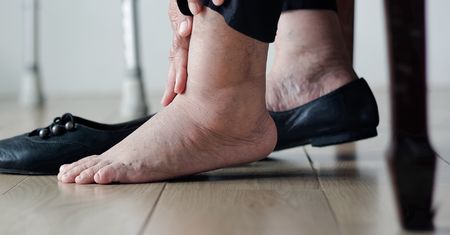 Nosisz takie buty? To prosta droga do grzybicy paznokci