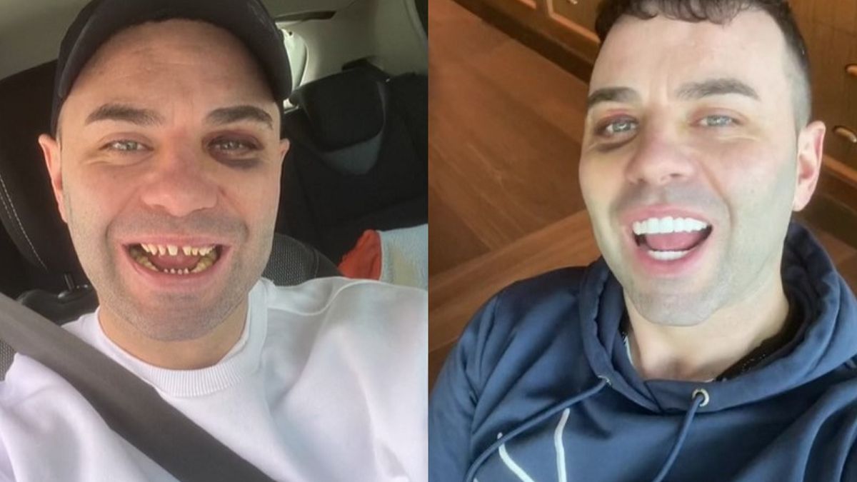 Zrobił sobie "tureckie zęby". Tak skomentowali to internauci. 