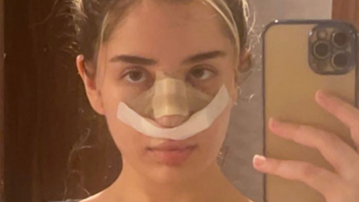 Zrobiła sobie nowy nos w Turcji. Tak teraz wygląda. 