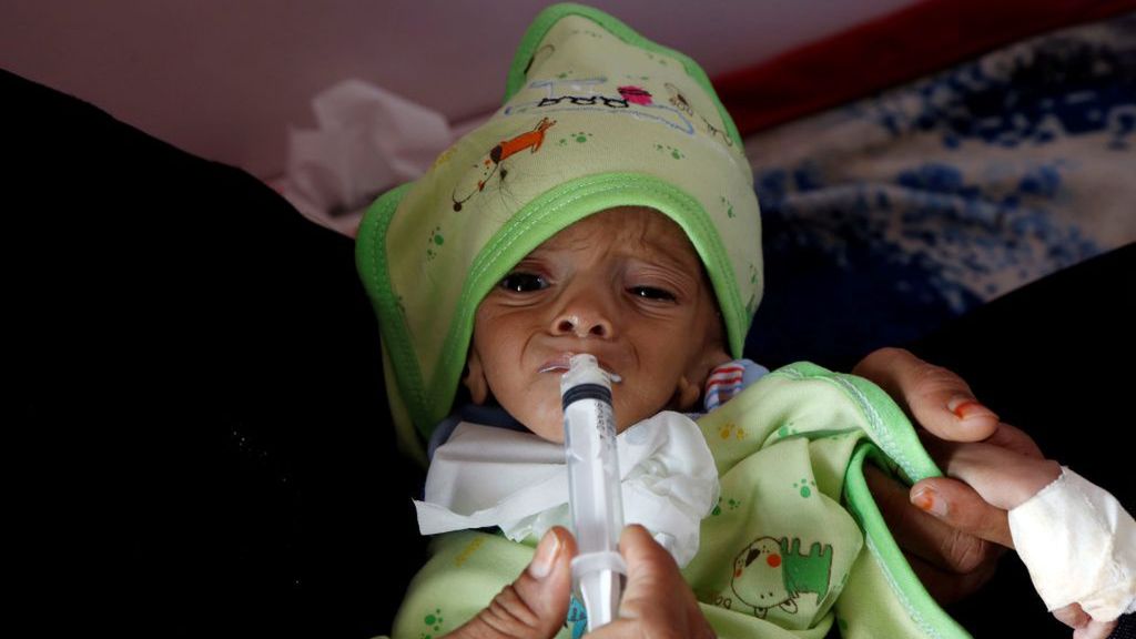 ONZ ostrzega przed klęską głodu