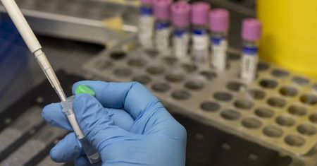 Legionella. Nowy raport sanepidu