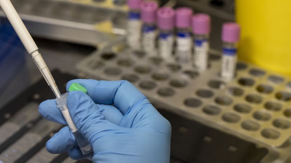 MADRID, SPAIN - JUNE 06: A medical laboratory technician inactivates suspected monkeypox samples to be PCR tested at the microbiology laboratory of La Paz Hospital on June 06, 2022 in Madrid, Spain. Europe is at the centre of the monkeypox virus outbreak, the World Health Organisation reported 780 confirmed cases with Britain, Spain and Portugal reporting the largest numbers of patients. (Photo by Pablo Blazquez Dominguez/Getty Images)