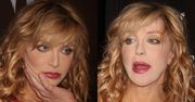 Nowa twarz Courtney Love? (ZDJĘCIA)