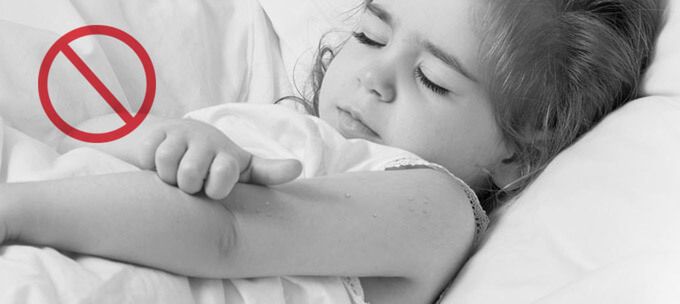 U dzieci mięczak zakaźny występuje najczęściej do 5 roku życia