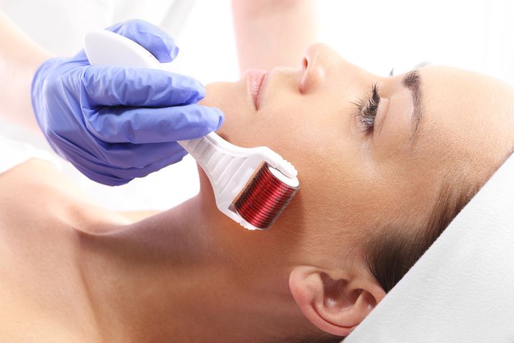 Mezoterapia mikroigłowa to jeden z najpopularniejszych zabiegów kosmetycznych na twarz.