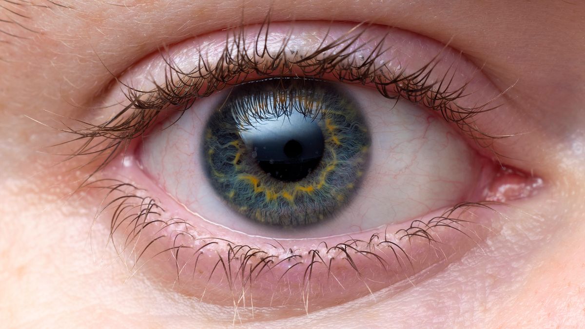 Syndrom oka biurowego