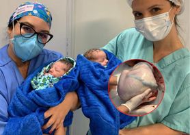 Nietypowy poród. Położne robiły zdjęcia