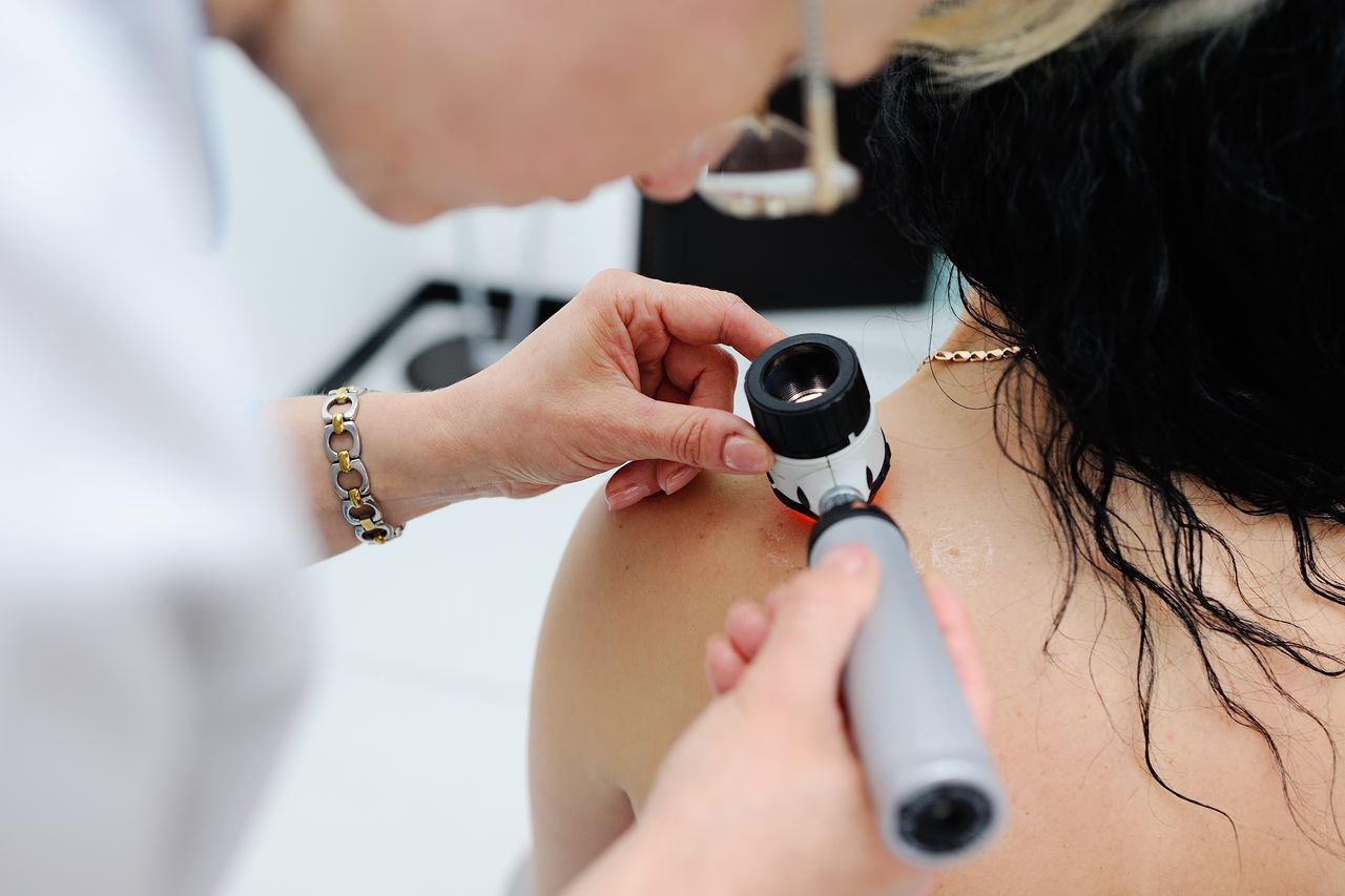 Prywatna wizyta u dermatologa. Co obejmuje i ile kosztują badania skóry?