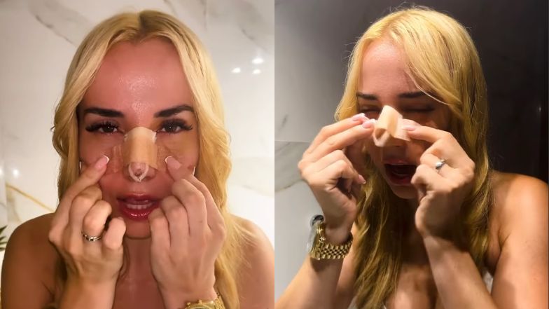 Marianna Schreiber ma nowy nos. Pochwaliła sie zdjęciem gipsu