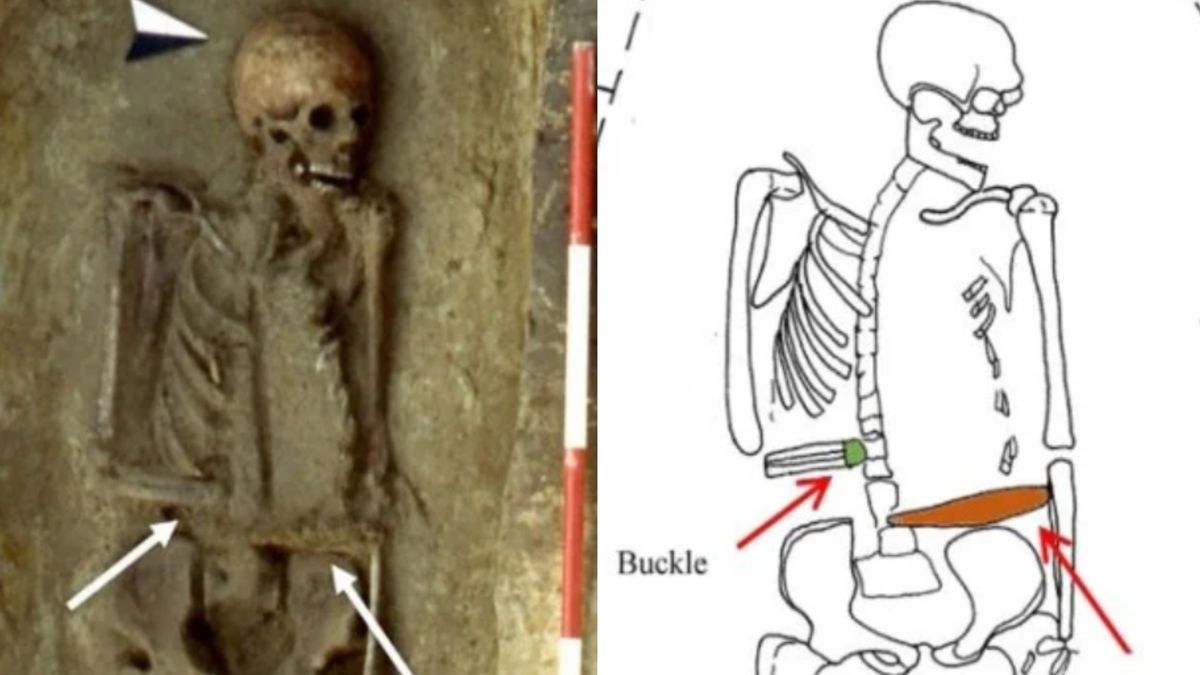 Wygląda na to, że pewien Włoch żyjący w średniowieczu amputowaną rękę zastąpił nożem przymocowanym do ramienia. 