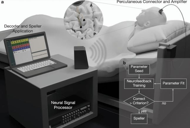 Eksperymentalna konfiguracja implantów mózgowych.