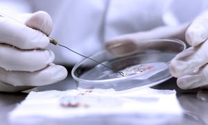 Lekarze mają coraz mniej możliwości. Ten grzyb uodpornił się na główne terapie
