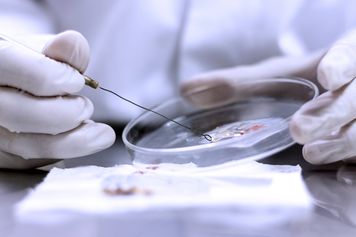 Lekarze mają coraz mniej możliwości. Ten grzyb uodpornił się na główne terapie
