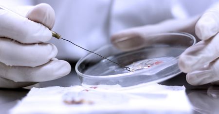 Lekarze mają coraz mniej możliwości. Ten grzyb uodpornił się na główne terapie