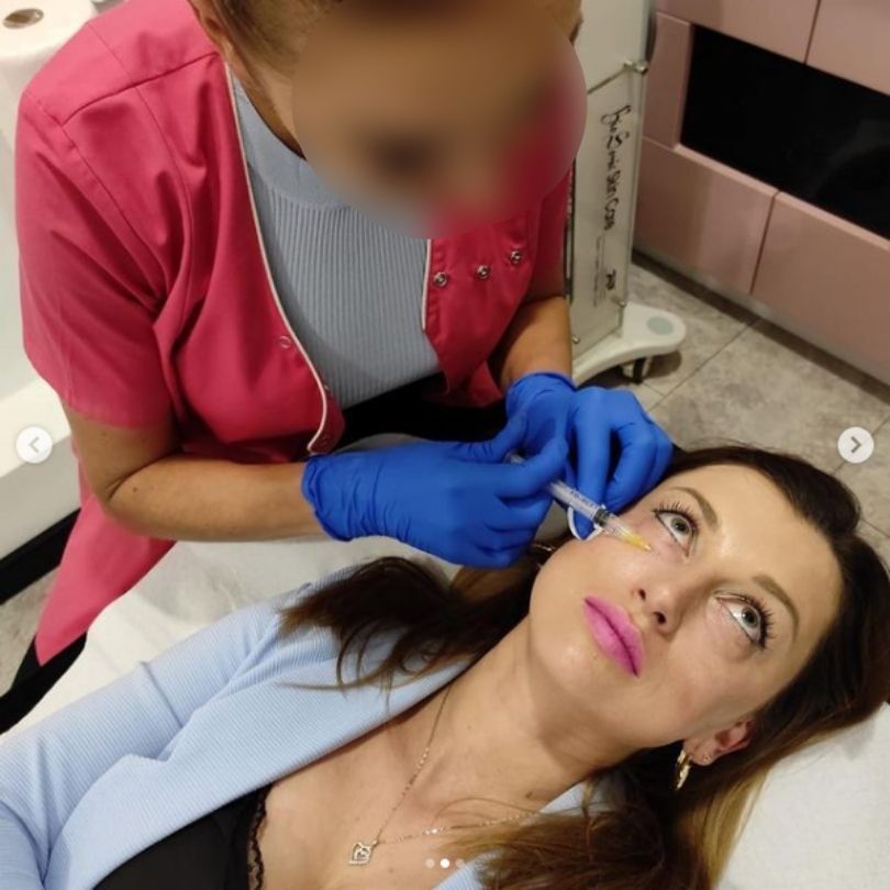 Justyna Żyła relacjonuje wizytę w klinice medycyny estetycznej
