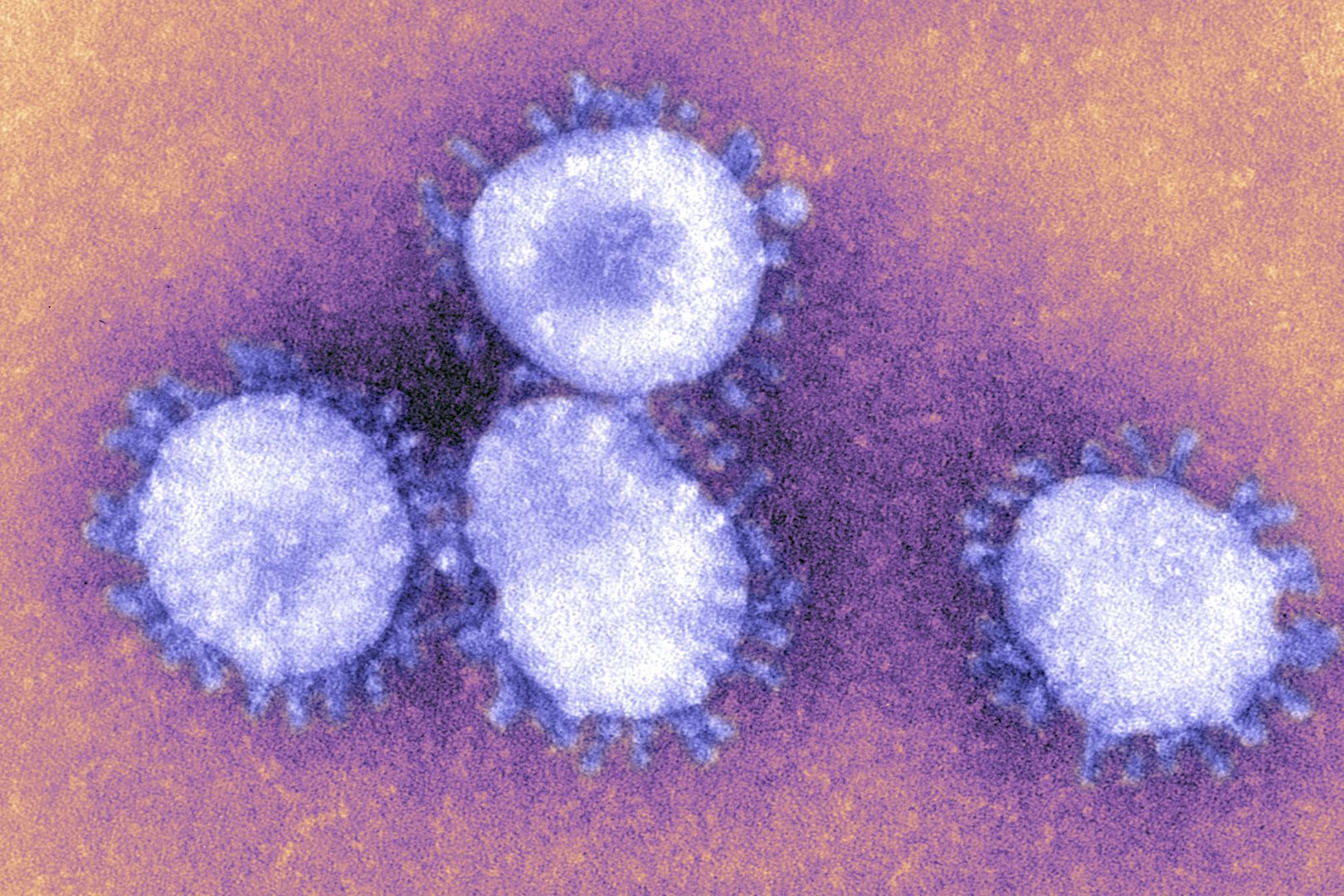 Czy na koronawirusa można się uodpornić? Prezes farmaceutycznego giganta wyjaśnia